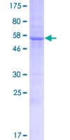 Human ERMP1 Protein (Recombinant GST)