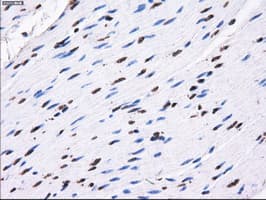 RPA2 / RFA2 / RPA34 Antibody (clone OTI7C12)