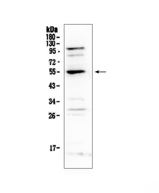 EPOR / EPO Receptor Antibody