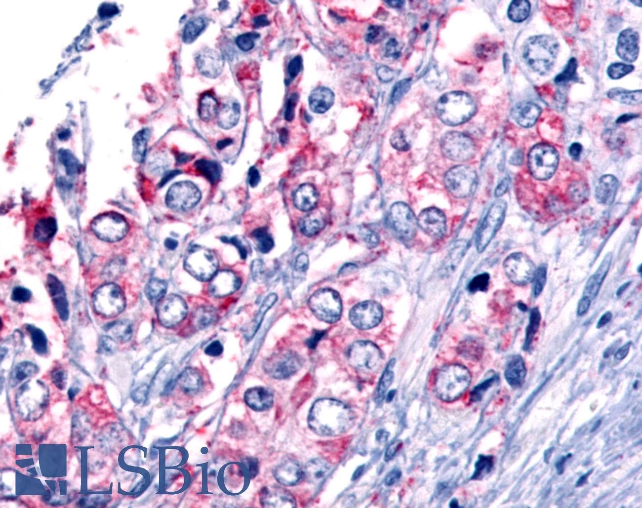 PathPlus™ Polyclonal Rabbit anti-Human GPR45 Antibody (C-Terminus, IHC)