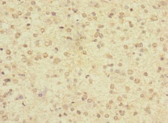Polyclonal Rabbit anti-Human LRRC4C Antibody (IHC)