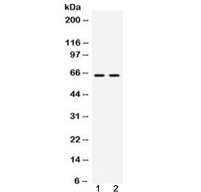 Polyclonal Rabbit anti-Human HNRNPL / hnRNP L Antibody (WB)