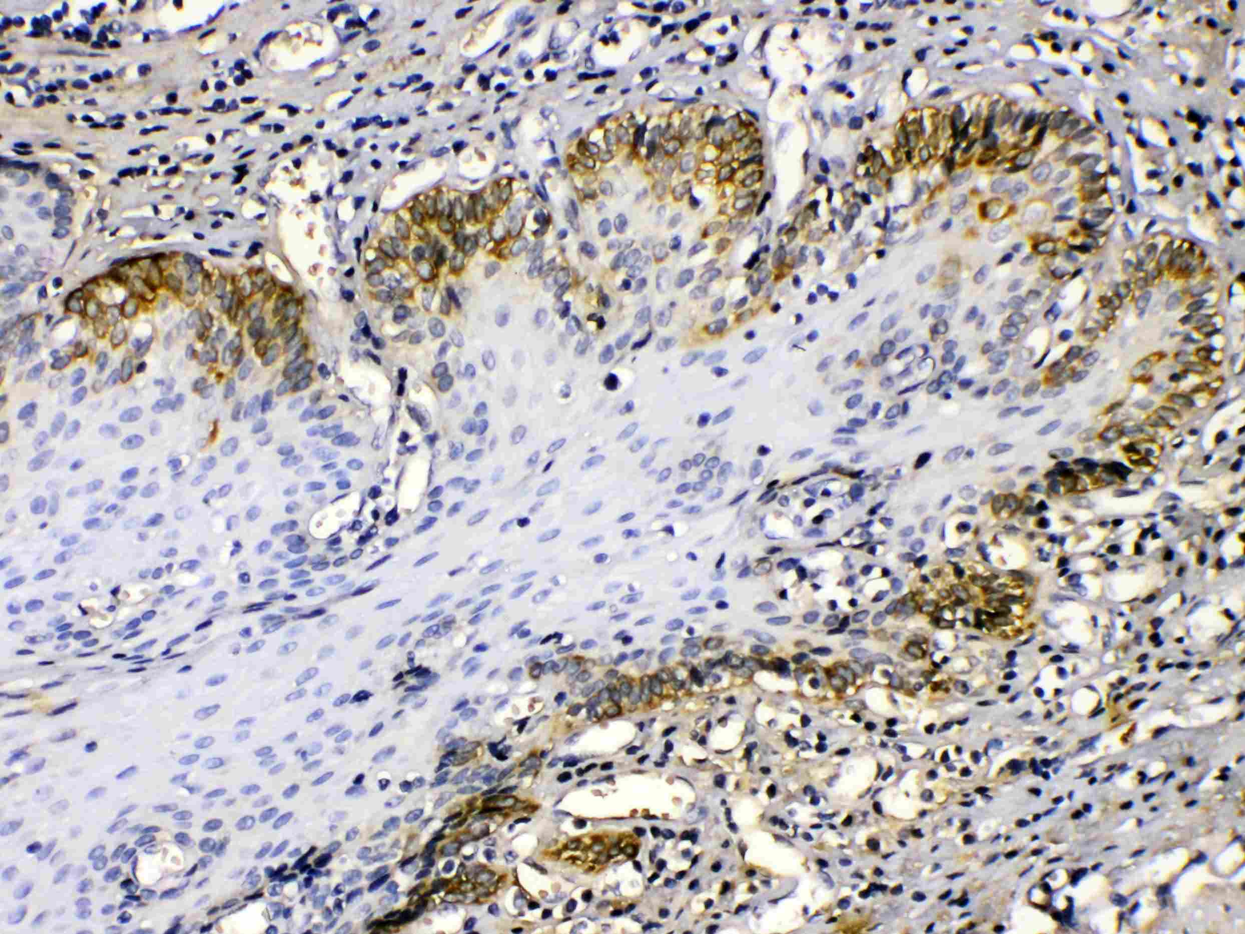 KRT14 / CK14 / Cytokeratin 14 Antibody