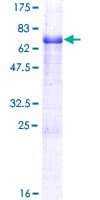 Human TMEFF1 / Tomoregulin 1 Protein (Recombinant GST)
