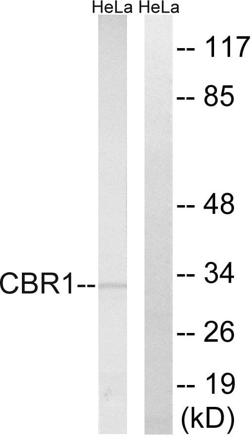 CBR / CBR1 Antibody