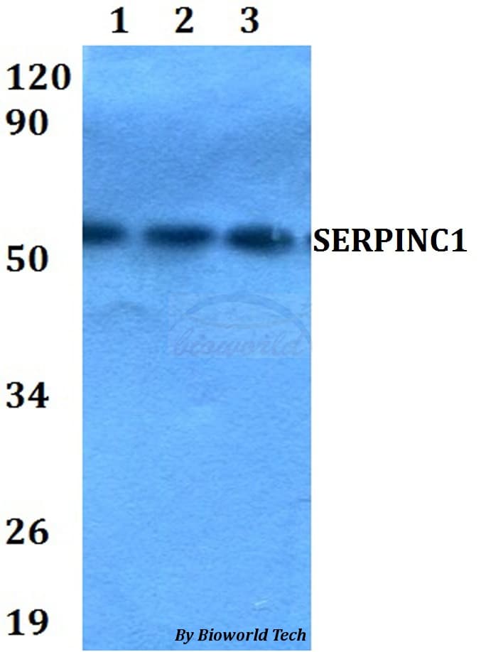 Antithrombin-III Antibody