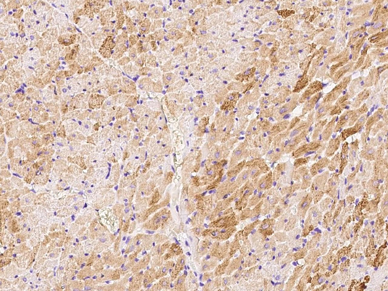 Polyclonal Rabbit anti-Human MAPK6 / ERK3 Antibody (Preservative Free, IHC)