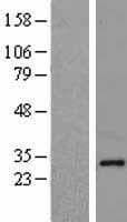 NDFIP1 / N4WBP5 Protein (Over-Expression Lysate Myc-DDK (Flag))