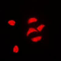 PBOV1 Antibody (Internal)