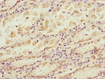 BLOC1S2 Antibody