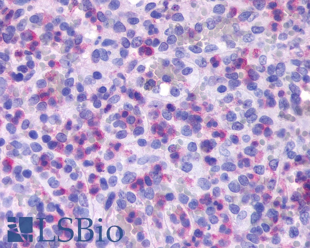 IHC-plus™ FPR1 / FPR Antibody (Extracellular Domain)