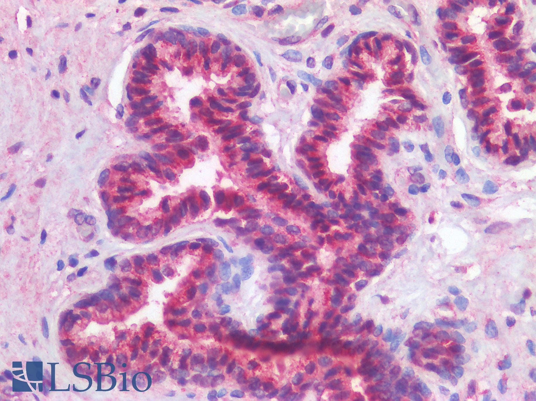 IHC-plus™ TP63 / p63 Antibody