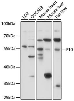 Polyclonal Rabbit anti-Human F10 / Factor X Antibody (WB)