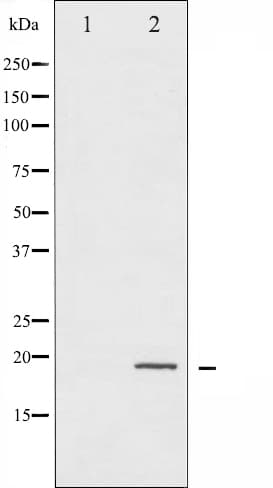 EIF4EBP1 / 4EBP1 Antibody (phospho-Thr36)