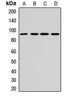 DDX20 / GEMIN3 Antibody