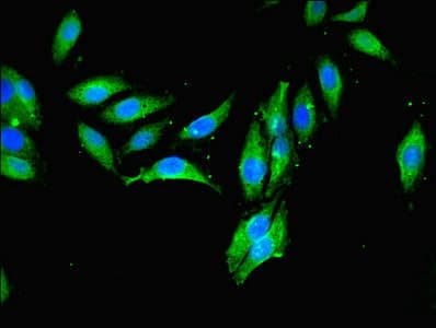 Polyclonal Rabbit anti-Human MCPH1 Antibody (aa536-835, IHC, WB)
