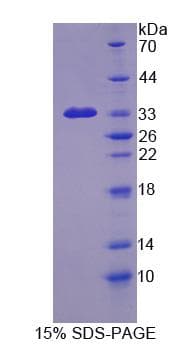 Human EML2 / EMAP2 Protein (Recombinant His-S)