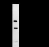 TAFII70 / TAF6 Antibody (clone 585D4a)