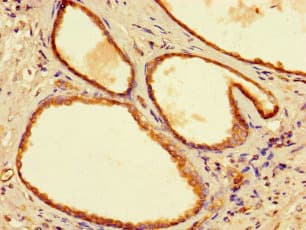 Polyclonal Rabbit anti-Human YIPF6 Antibody