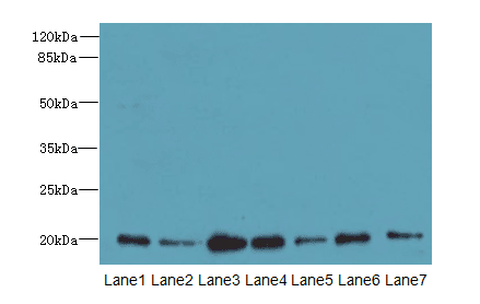 Polyclonal Rabbit anti-Human COPZ1 Antibody (IHC, WB)
