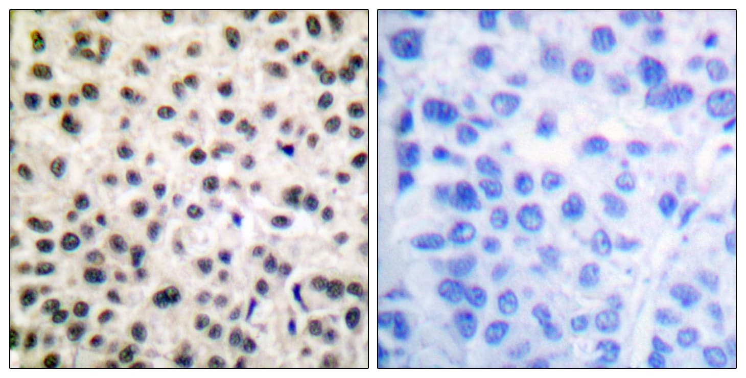 MEF2A / MEF2 Antibody (phospho-Ser408)