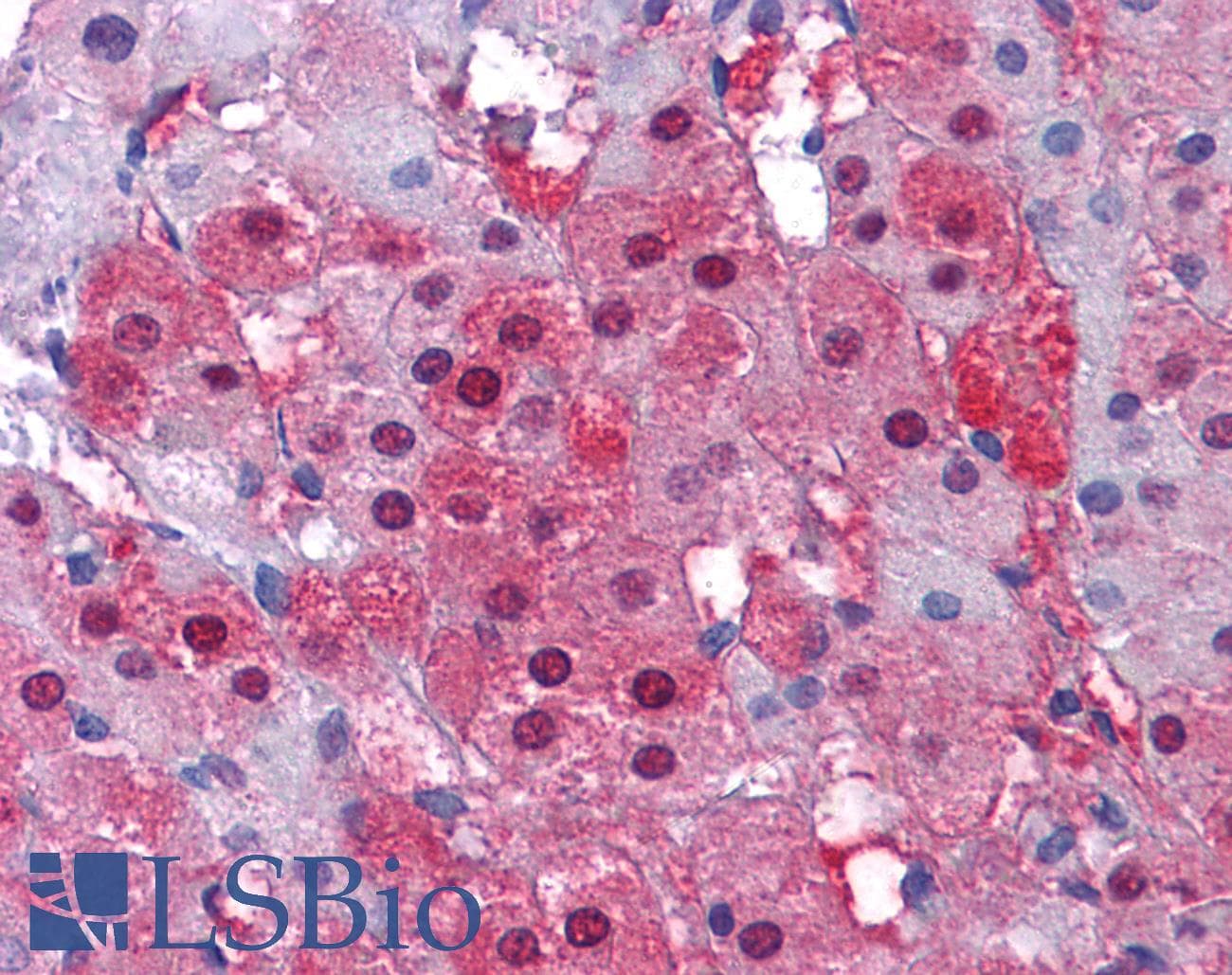 IHC-plus™ IDH1 / IDH Antibody