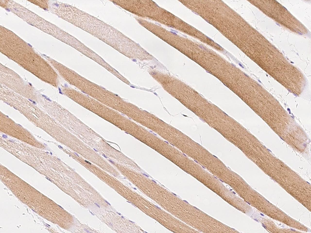 Polyclonal Rabbit anti-Human FASTKD3 Antibody (IHC)