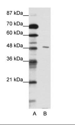 Polyclonal Rabbit anti-Human PBX2 Antibody (N-Terminus, IHC, WB)