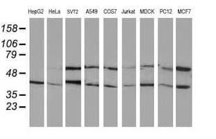 PPM1B Antibody (clone OTI3F2)