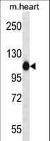 ACTN2 Antibody (aa751-779)