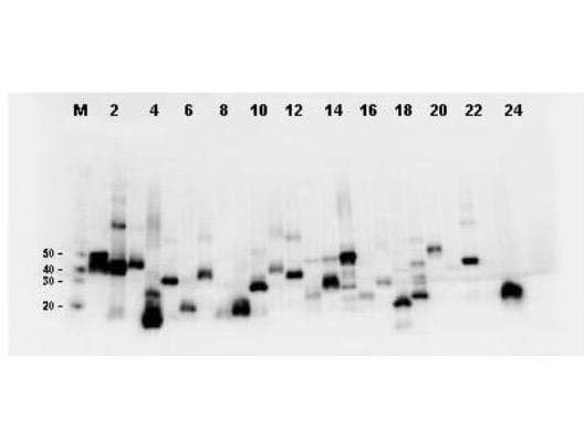 DYKDDDDK Tag Antibody (clone 29E4.G7)