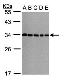 Polyclonal Rabbit anti-Human Vps60 / CHMP5 Antibody (aa1-202, IHC, WB)