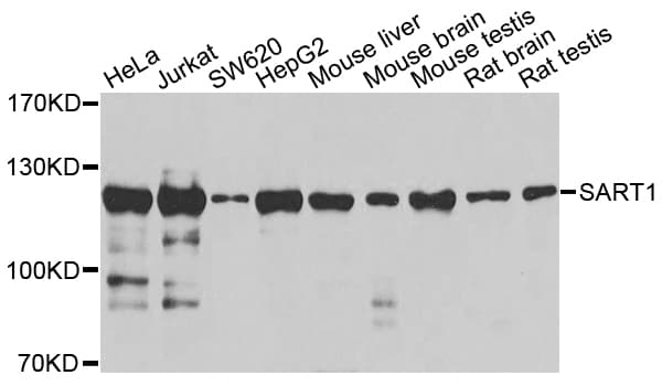 Polyclonal Rabbit anti-Human SART1 Antibody (WB)