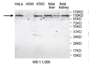 Polyclonal Rabbit anti-Human AP4E1 / Adaptin Epsilon Antibody (aa951-1136, IHC, WB)