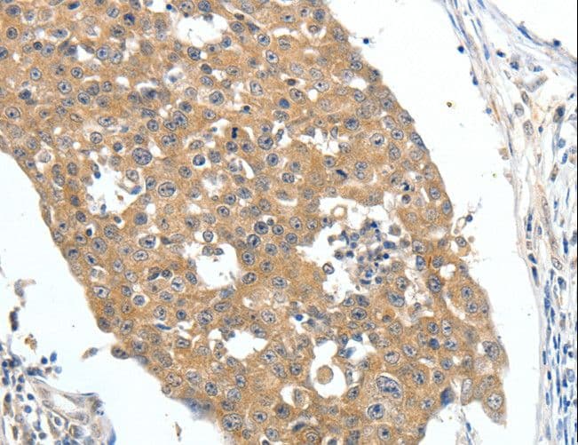 Polyclonal Rabbit anti-Human FSH Receptor / FSHR Antibody (IHC)
