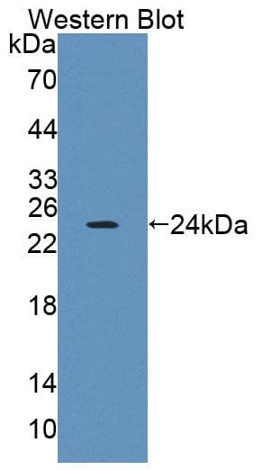 PTPRA / RPTP-Alpha Antibody (Biotin)