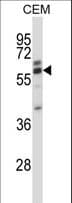 CORO2A Antibody (aa185-213)
