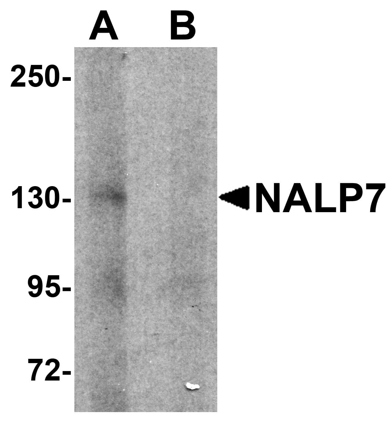 IHC-plus™ NLRP7 / NALP7 Antibody