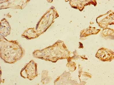NHLRC2 Antibody