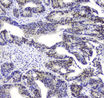 SQSTM1 Antibody