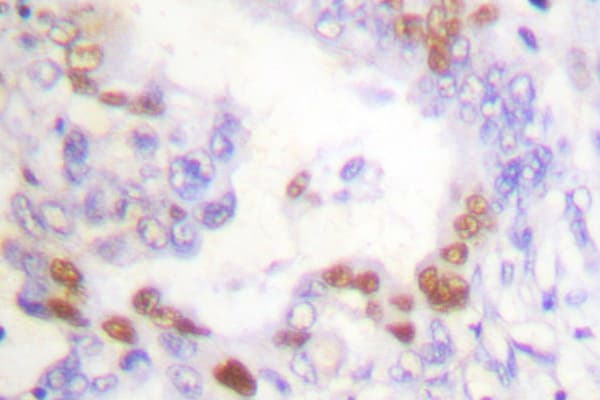 Polyclonal Rabbit anti-Human FANCD2 Antibody (Pro216, IHC, WB)
