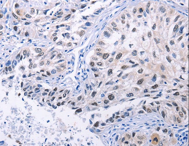 Polyclonal Rabbit anti-Human HMGB3 Antibody (IHC, WB)