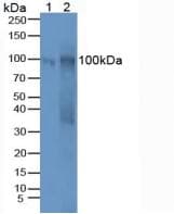 MUC16 / CA125 Antibody (aa2-258)