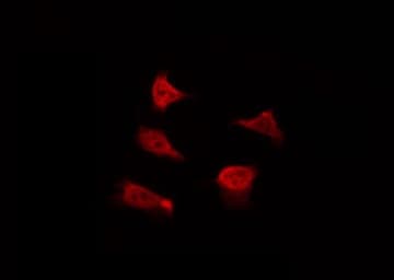 EZR / Ezrin Antibody (phospho-Tyr478)