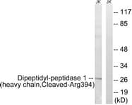 CTSC / Cathepsin C / JP Antibody (aa345-394)