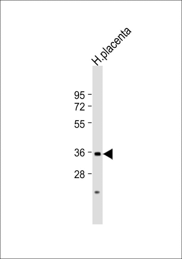 ACER3 Antibody