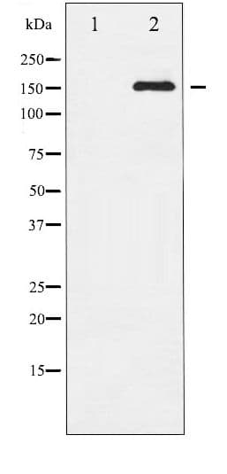 KDR / VEGFR2 / FLK1 Antibody (phospho-Tyr951)
