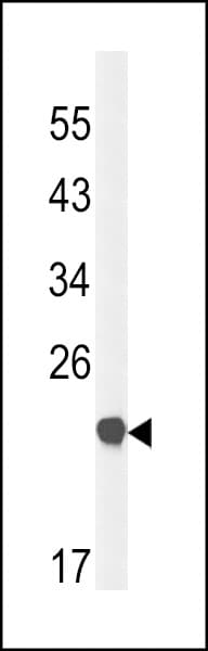Polyclonal Rabbit anti-Human CLDN23 / Claudin 23 Antibody (aa228-257, IHC, WB)
