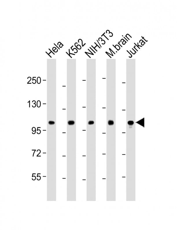 DNM2 / Dynamin-2 Antibody (N-Terminus)
