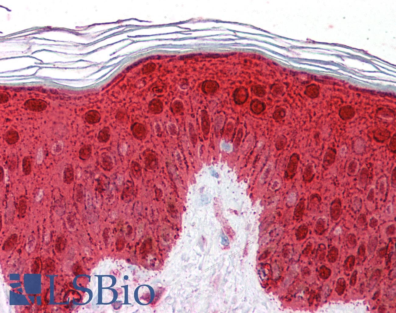 SFN / Stratifin / 14-3-3 Sigma Antibody (aa179-228)
